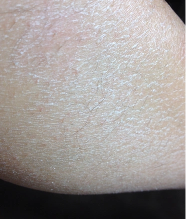 冬天皮肤干燥起皮,身体乳一定要用对,这款身体乳韩国妹子都在用