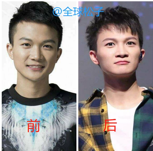 与出道前相比,周深的颜值"蜕变",从路人变成了小帅哥