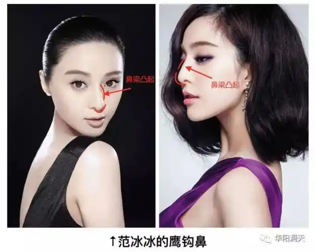 驼峰鼻带鹰勾_鹰勾鼻_强制戴鼻勾灌水