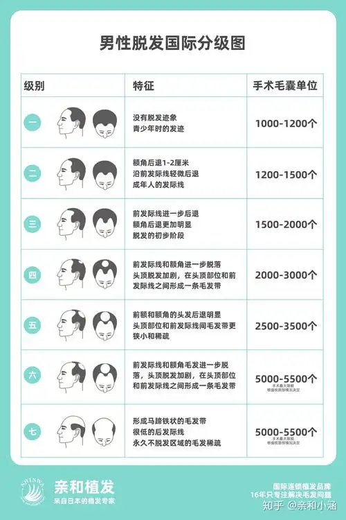快来看看自己是几级脱发吧,这些等级的脱发要开始注意了! - 知乎