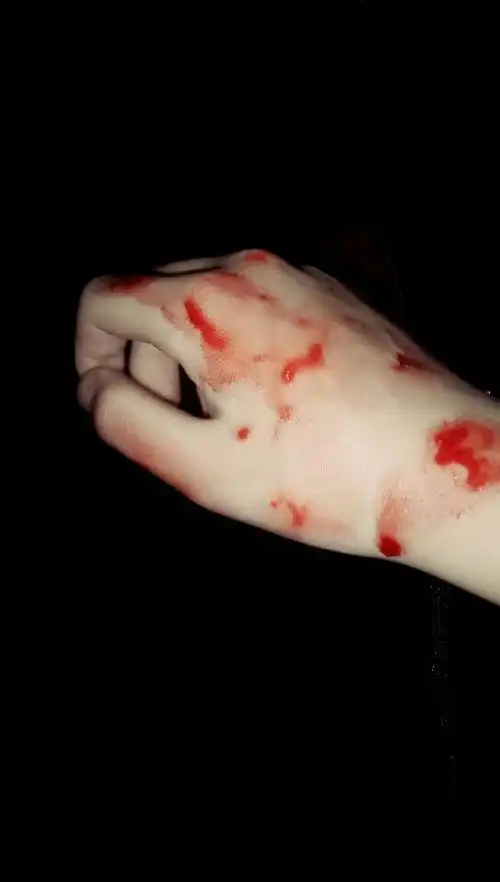 挖了什么心脏,肝,肾.总是会想这些,怎么办