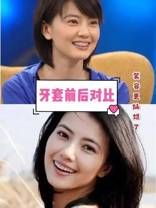 明星的变化—高圆圆