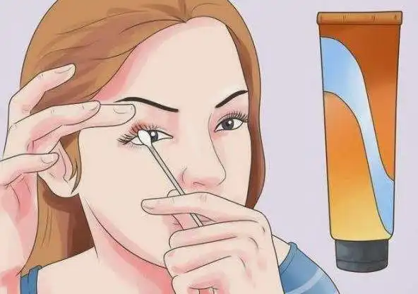 特别提醒:常用抗生素滴眼液及眼膏按药物说明书使用或者遵医嘱用药