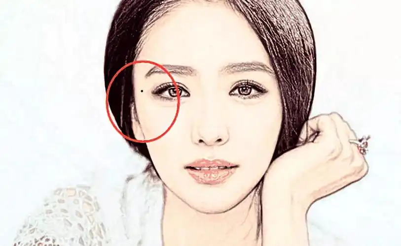 克夫痣,女人脸上五处痣不能留!