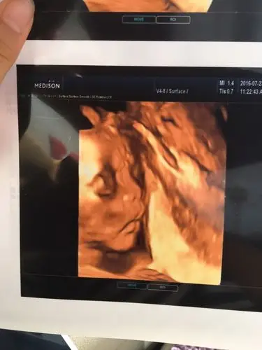 我家宝宝的四维照片,女孩,想知道出生后漂亮不