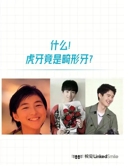 95虎牙是怎么形成的?