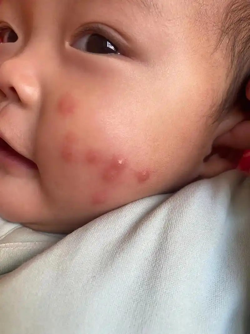 万能的抖音有没有人知道孩子脸上这是什么.