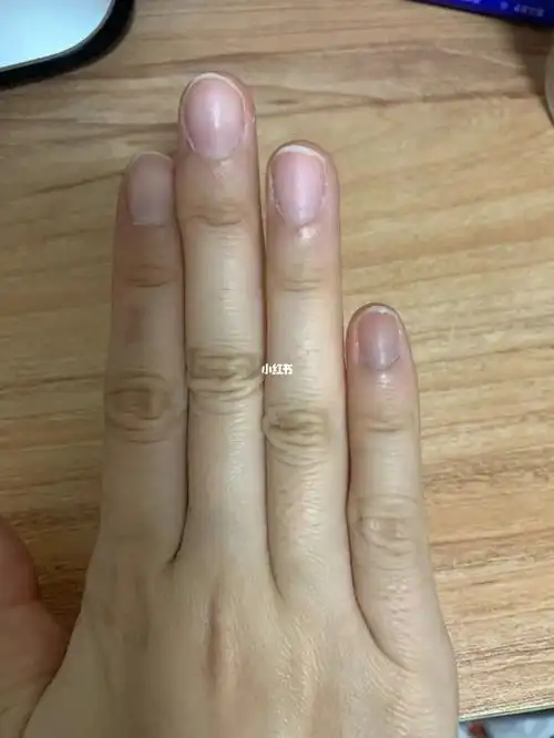 指甲紫了