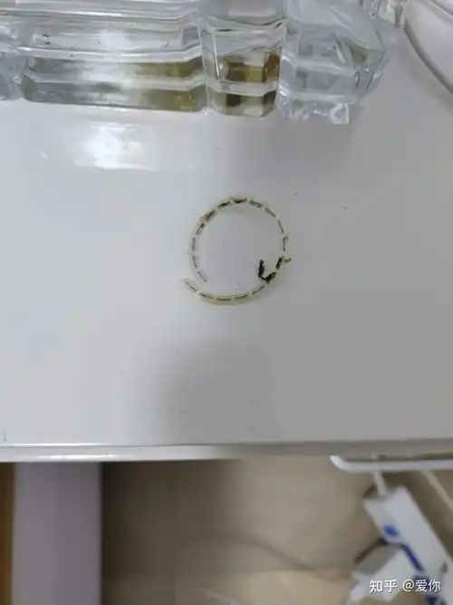 环切包皮手术大家的钛钉都是多久掉了啊大家用盐水泡了吗我两周才掉了