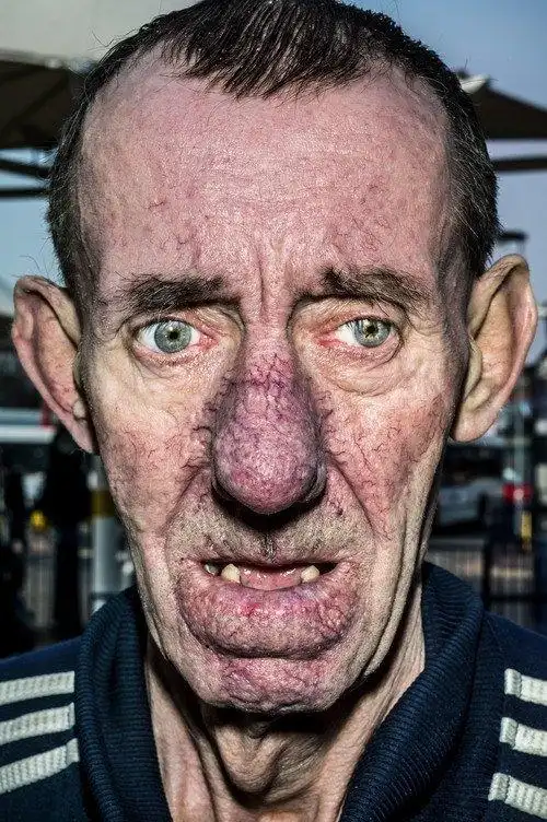 丑出天际!摄影师捕捉丑陋面孔