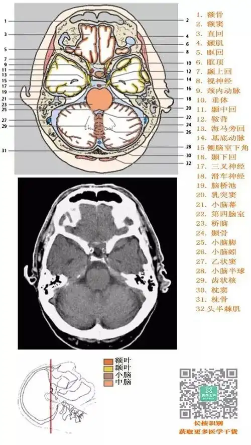 一套非常牛的「头颅ct解剖图谱」