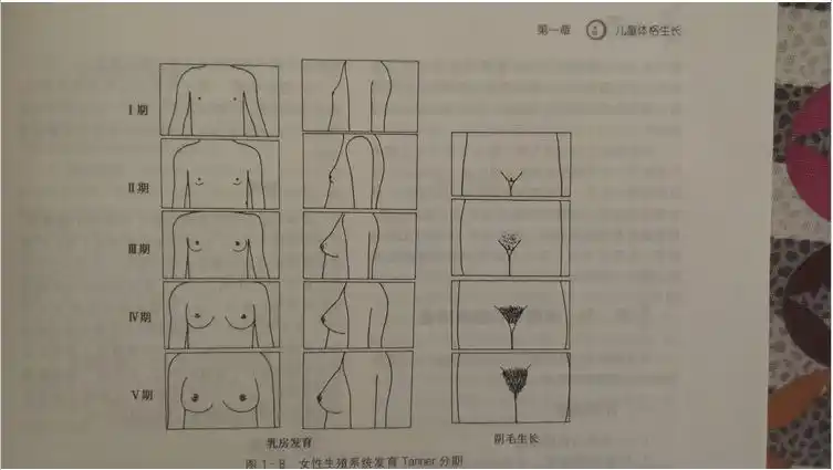 女孩子性发育的分期 - 好大夫在线