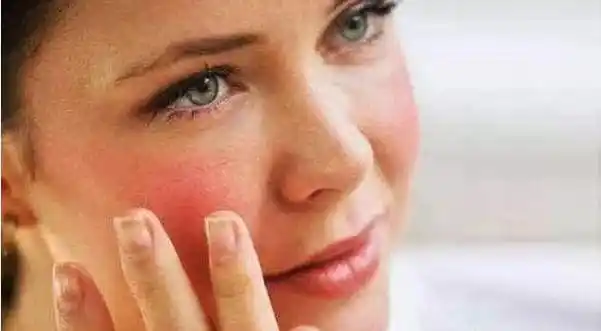 皮肤发红,灼烧,瘙痒,刺痛,干燥,紧绷……这就是"敏感肌"的日常活动.