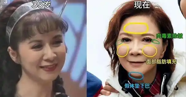 女明星整容过度,有多吓人?