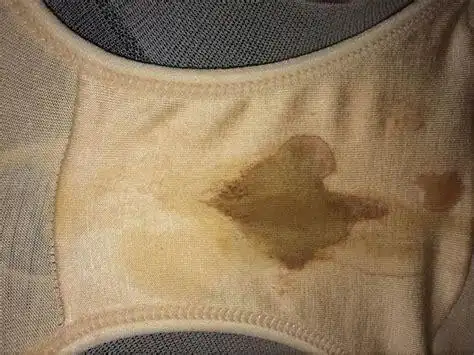 白带总是带血怎么回事