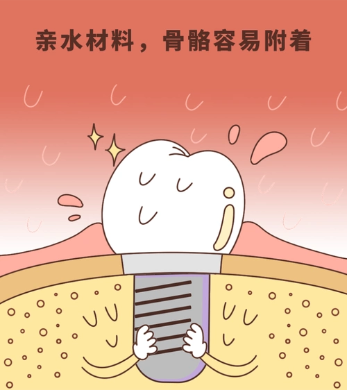 普通人有必要用亲水种植牙吗?和非亲水相比哪个更好一点?_大连口腔网
