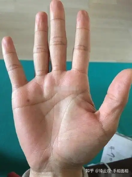 手指缝隙较大,水星丘有痣,生命线末端分叉,和事业线形成一个较大的财