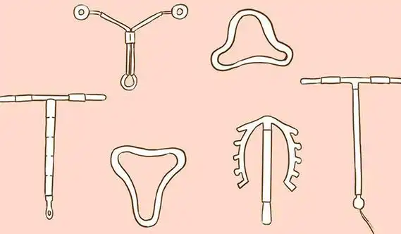 节育环的种类有哪些?求形状图片以及最新价格表!-十月幸孕