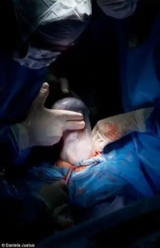 组图:摄影师记录妈妈们分娩瞬间 辛酸却美丽_高清图集_新浪网