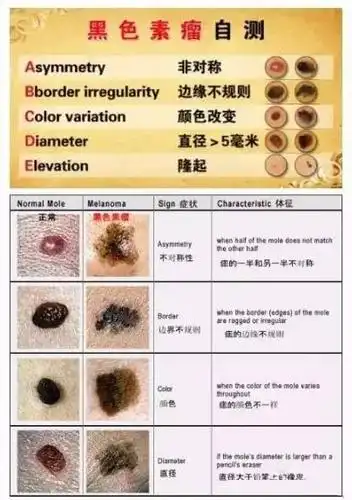 许多人对身上的黑痣能否接受治疗和到医院哪个科室诊治产生困惑.
