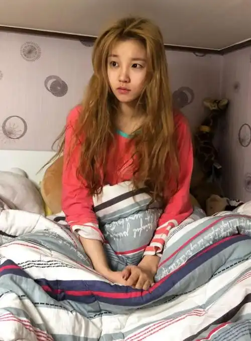 宋雨琦的纯素颜照片曝光,皮肤暗淡发黄,网友:抱歉,认错人了