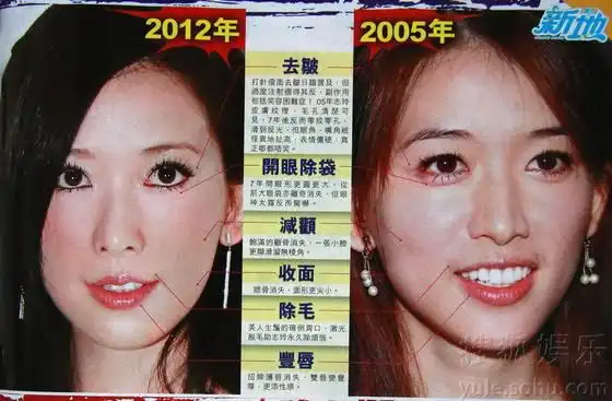 林志玲脸肿似橡胶堪比萧蔷揭两代美女变形记组图