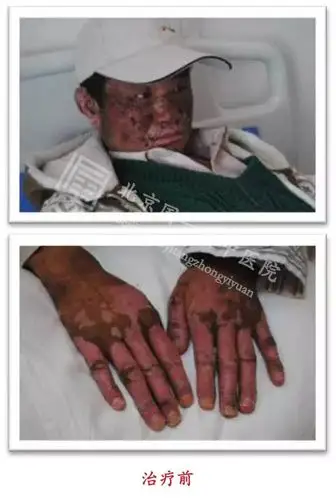 她曾美过范冰冰,却因患红斑狼疮穷困潦倒