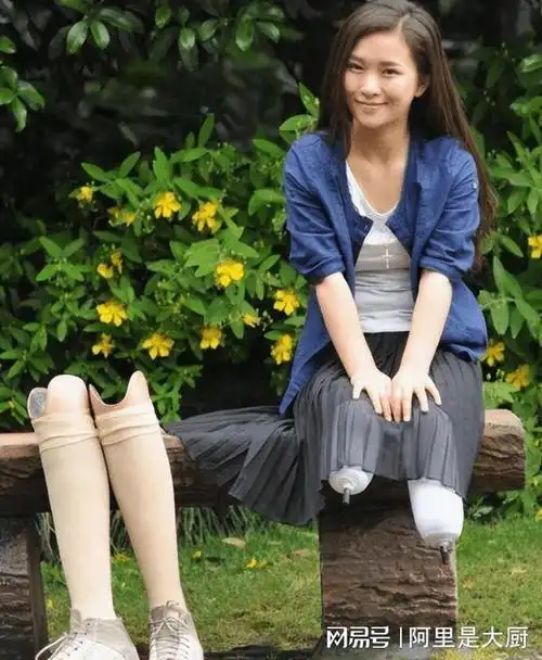 这一次,和刘畊宏共舞的"截肢女孩"廖智,给网红圈好好上了一课|假肢|刘