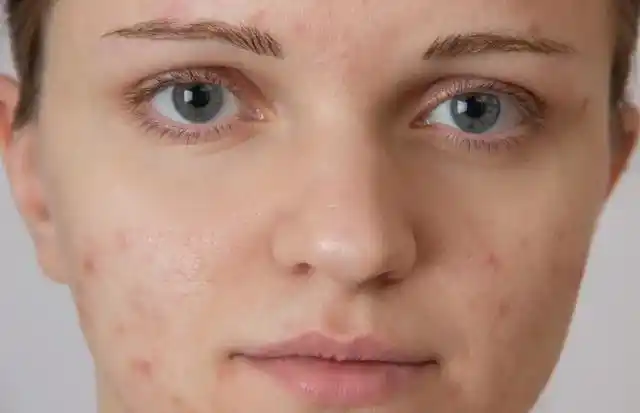 为什么你的肤色暗沉无光,想要美白皮肤就要学会六个技巧