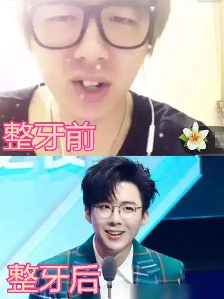 整牙前vs整牙后的差距有多狠杨幂vs杨颖看到刘宇宁男神梦破碎了
