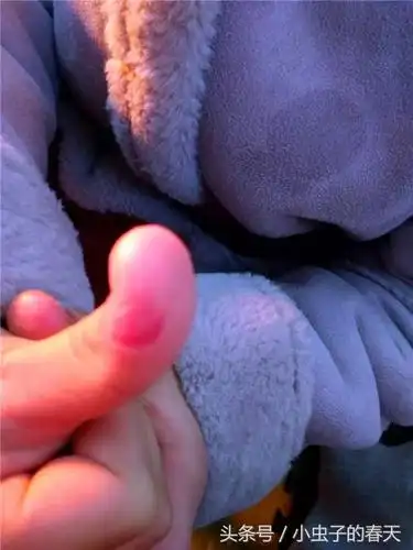 孩子咬过的手指甲,当妈的看着心疼