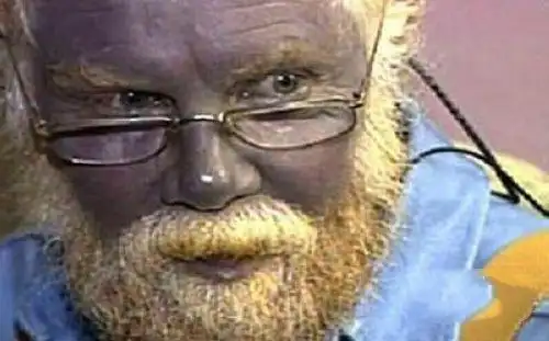 蓝血人种是新人种撒哈拉沙漠蓝血人种血液照片