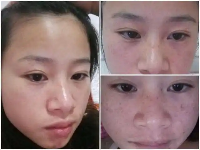 皮肤变差,怎么办啊?