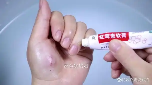 家有红霉素软膏的留心,这4个妙用太聪明了,现在清楚不迟