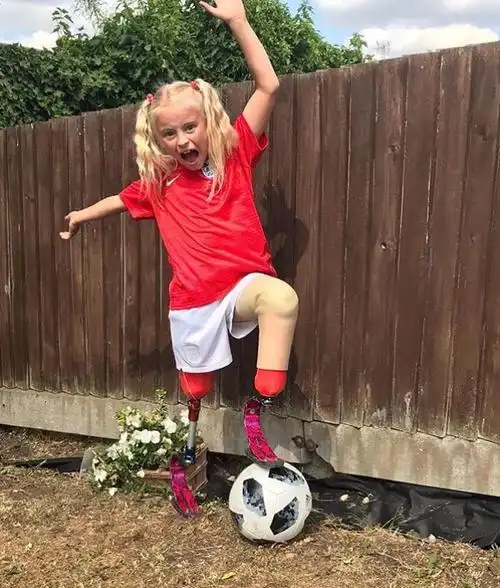 生来残缺,备受欺凌,她却做了一个这样的决定…|假肢|女孩|双腿_新浪