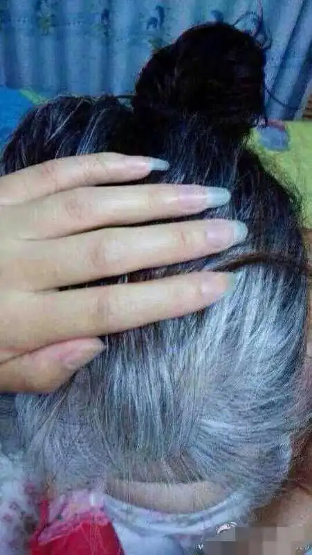 我是男孩,16岁有好多白头发是咋搞的!咋冶?