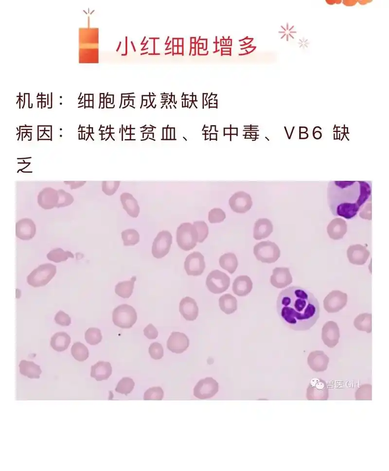 10.29日学习打卡 #血涂片中的红细胞异常 #学习打卡#血 - 抖音