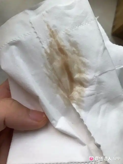 孕早期一直流褐色分泌物,有图,慎入.有没有希望状况的妈妈?