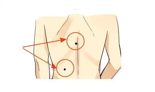 身上有这三颗大吉痣,最有福气,一生有望大富大贵,好运连连