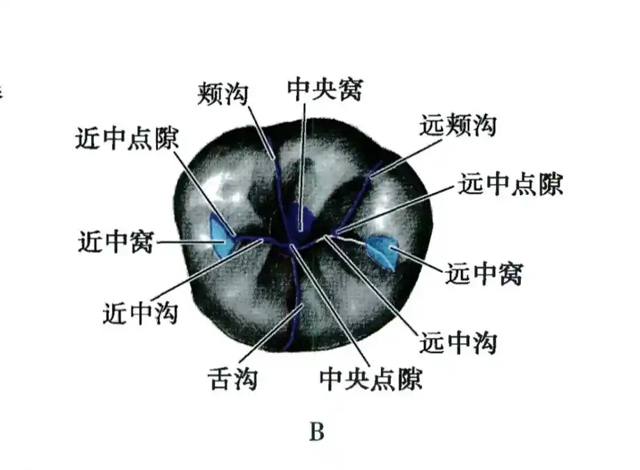 口解——下颌第一磨牙图谱.熟记该牙各个观测面解剖形态 #口腔 - 抖音