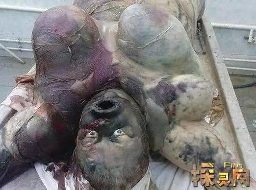 腐败巨人观恶心至极人死后尸体会不断膨胀巨大化如同气球