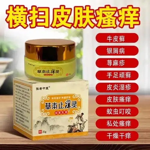 抑菌乳膏草本止痒灵针对各种皮肤疹子严重湿疹荨麻疹风疹过敏小儿尿疹