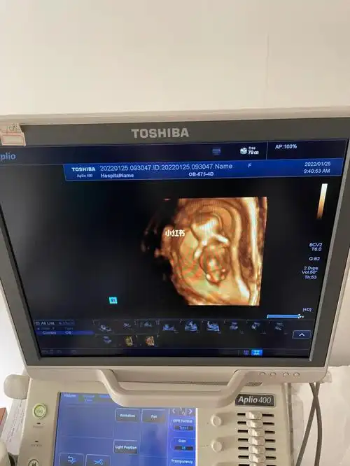 nt秒过这能看出来男孩女孩