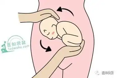 胎位不正只能剖?这几种胎位纠正法很有效