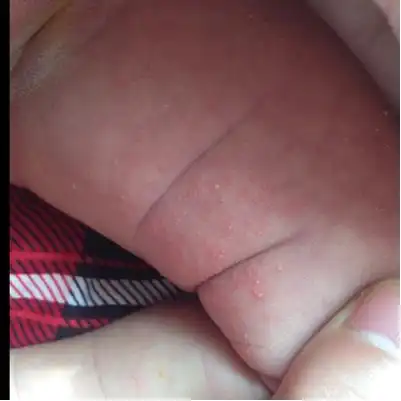 女宝贝大腿内侧,这是什麼啊_宝宝树