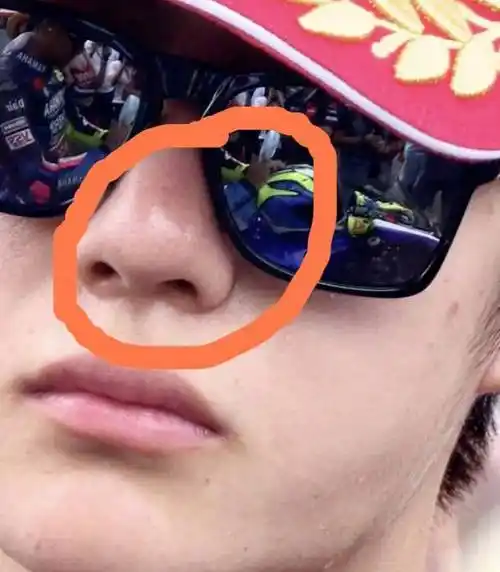 原创王一博遭遇质疑整容超高清面部照片曝光网友看到了鼻翼切口