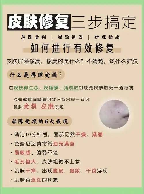 皮肤屏障受损?教你三步修复法!