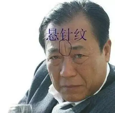 山根横纹(一条则一次大灾,二条二次,三条三次).