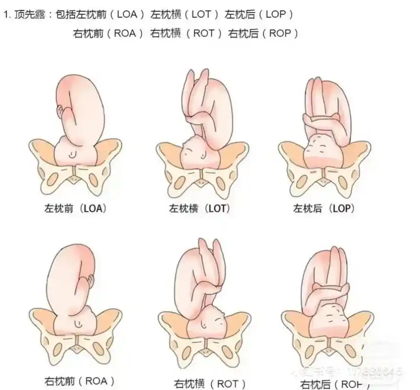 34周半入盆,36周全入盆 ,最近情况是分泌物变多,胎动变重,下腹部哦