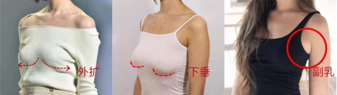 胸部没有支撑,在地心引力的作用下,很快就会下垂,外扩,胸型越来越难看